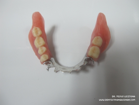Denture Care - dentistpangasinan.com